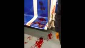 Sillas manchadas de sangre del metro de Barcelona