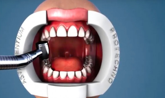 El sistema Oral BioFilter supone una innovación en el sector de la odontología / YOUTUBE