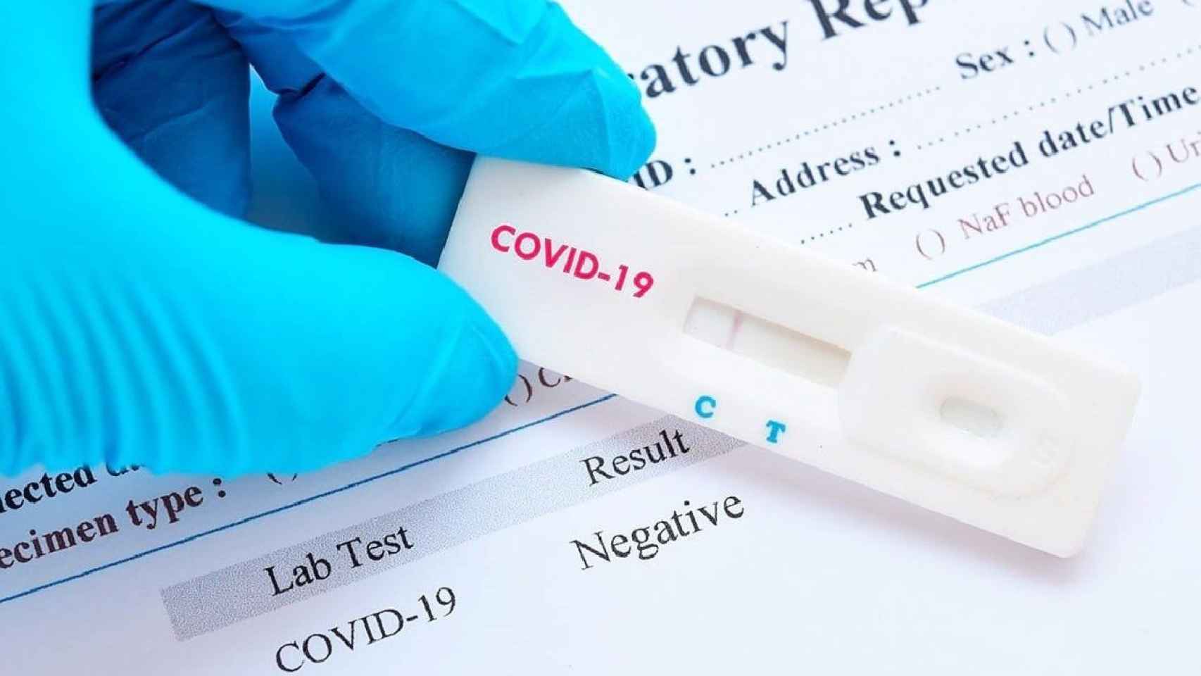 Test de detección rápida del coronavirus / DIBA