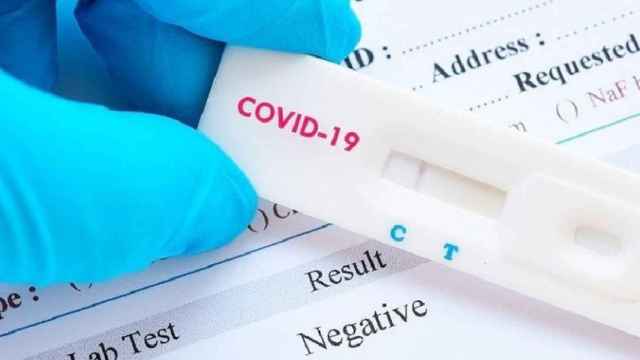 Test de detección rápida del coronavirus / DIBA