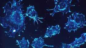 Una imagen de células de cáncer / ARCHIVO