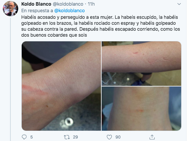 Tuit de Koldo Blanco sobre la agresión a su mujer / TWITTER KOLDO BLANCO