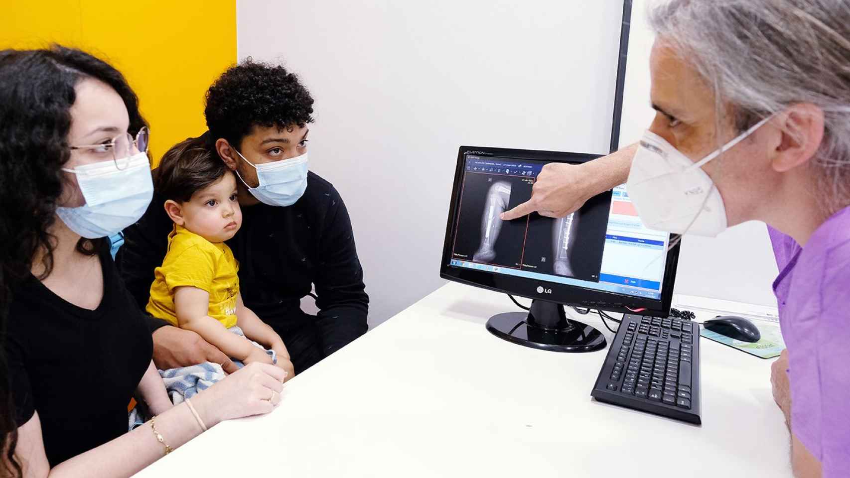 Isaac, el niño operado de una pseudoartrosis congénita en Barcelona / HOSPITALS HM NENS