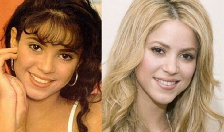 El antes y el después de la cantante colombiana Shakira