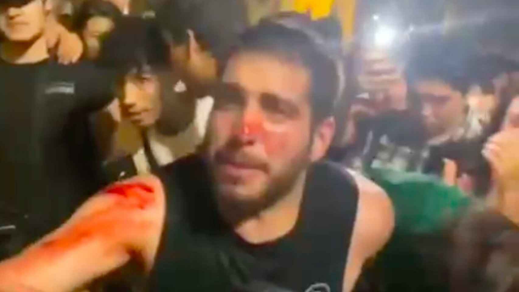 Un joven sangra en una pelea por diversión en Barcelona / 'BCN LEGENDS' - TELEGRAM