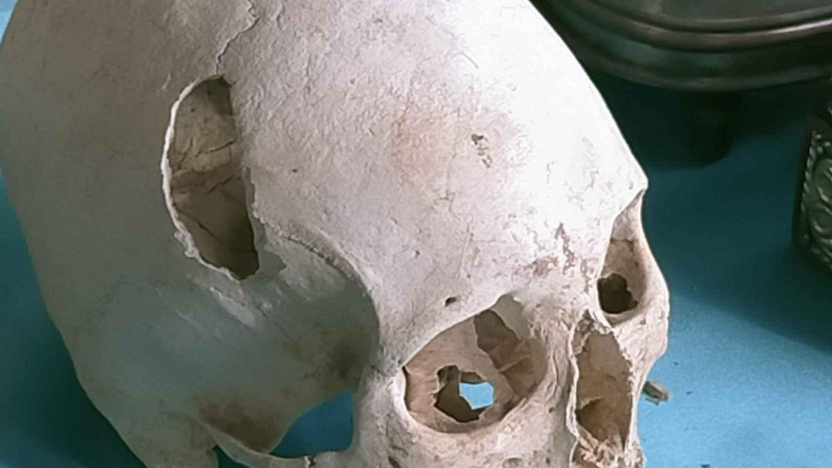 Cráneo humano fotografiado por un ciudadano en el Mercat dels Encants / CEDIDA