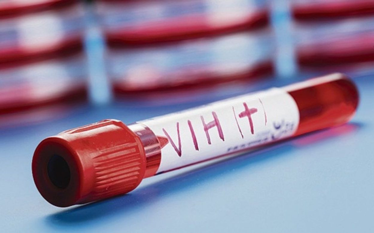 Se cumplen 40 años del primer diagnóstico de VIH en España / EFE