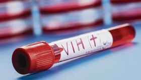 Investigación del VIH en España / EFE
