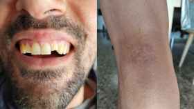 Un diente roto y moratones tras la agresión a un joven en la estación de Rodalies de Mataró / GALIA DVORAK