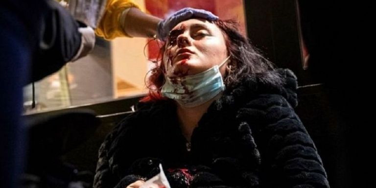 El 16 de febrero, en el transcurso de una protesta por en encarcelamiento de Hasel, una joven de 19 años perdió un ojo / EFE