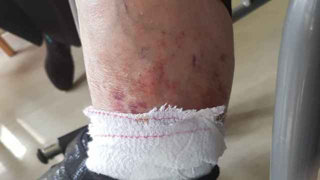 Imagen de heridas de la tutelada por la fundación / CEDIDA