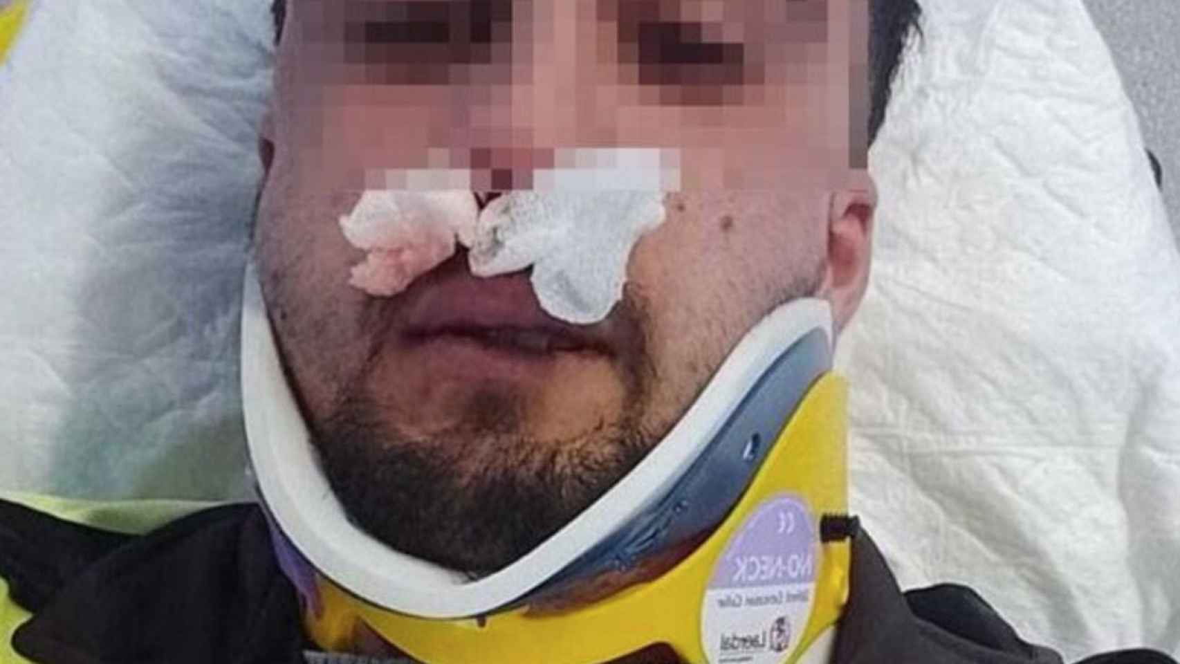 Vigilante agredido en una paliza grupal el jueves en Mataró / CAPGRÒS.COM