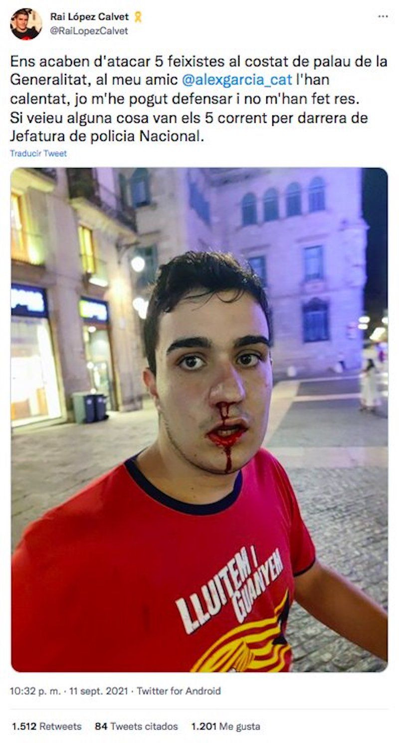 Víctima de un ataque ultra denuncia los hechos en redes sociales.
En la foto, el joven atacado con la cara ensangretada / RAI LÓPEZ CALVET - TWITTER