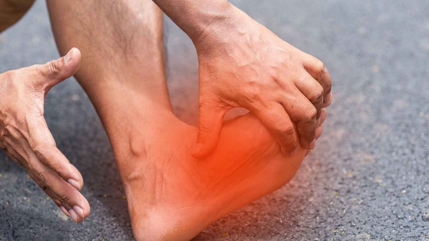 La metatarsalgia es un dolor que se localiza en la planta del pie